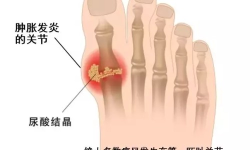 糖尿病人吃鱼籽一次吃多少合适-糖尿病人吃鱼子网 - 网站提供糖尿病人吃鱼子的好处小常识、糖尿病人吃鱼子行吗